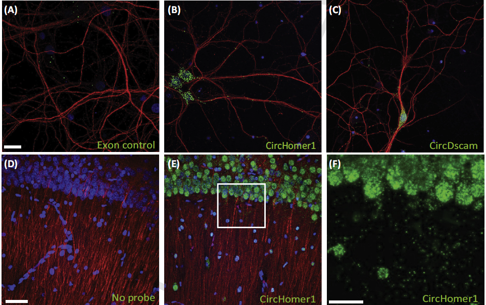 SUSTech Professor Wei Chen and Professor Erin Schuman from Max-Planck-Institute for Brain Research jointly published a review in Trends in Neuroscience