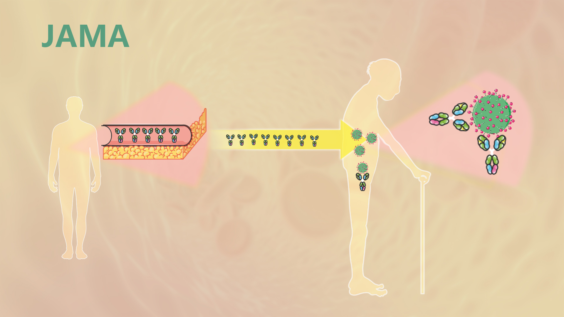 Plasma of recovered patients could help treat critically ill COVID-19 sufferers