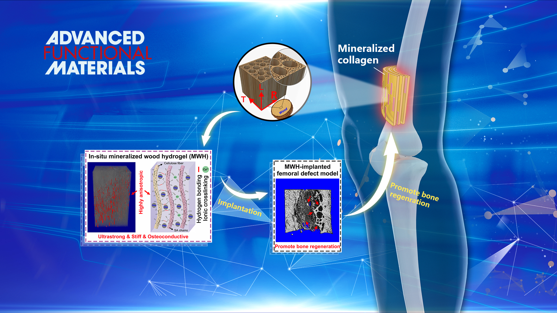 SUSTech Fuzeng Ren’s research group make advances in orthopedic biomaterials