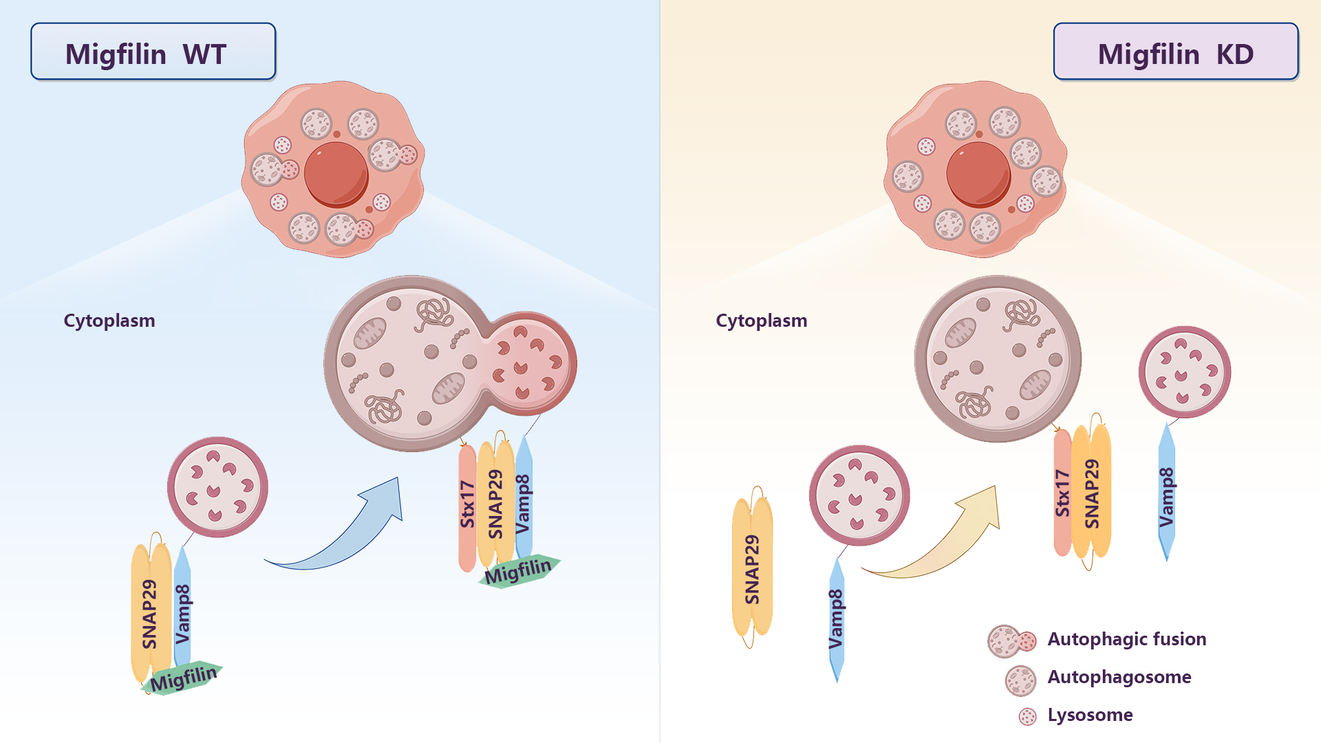 Researchers reveal how Migfilin enhances autophagy regulation in cancer cells