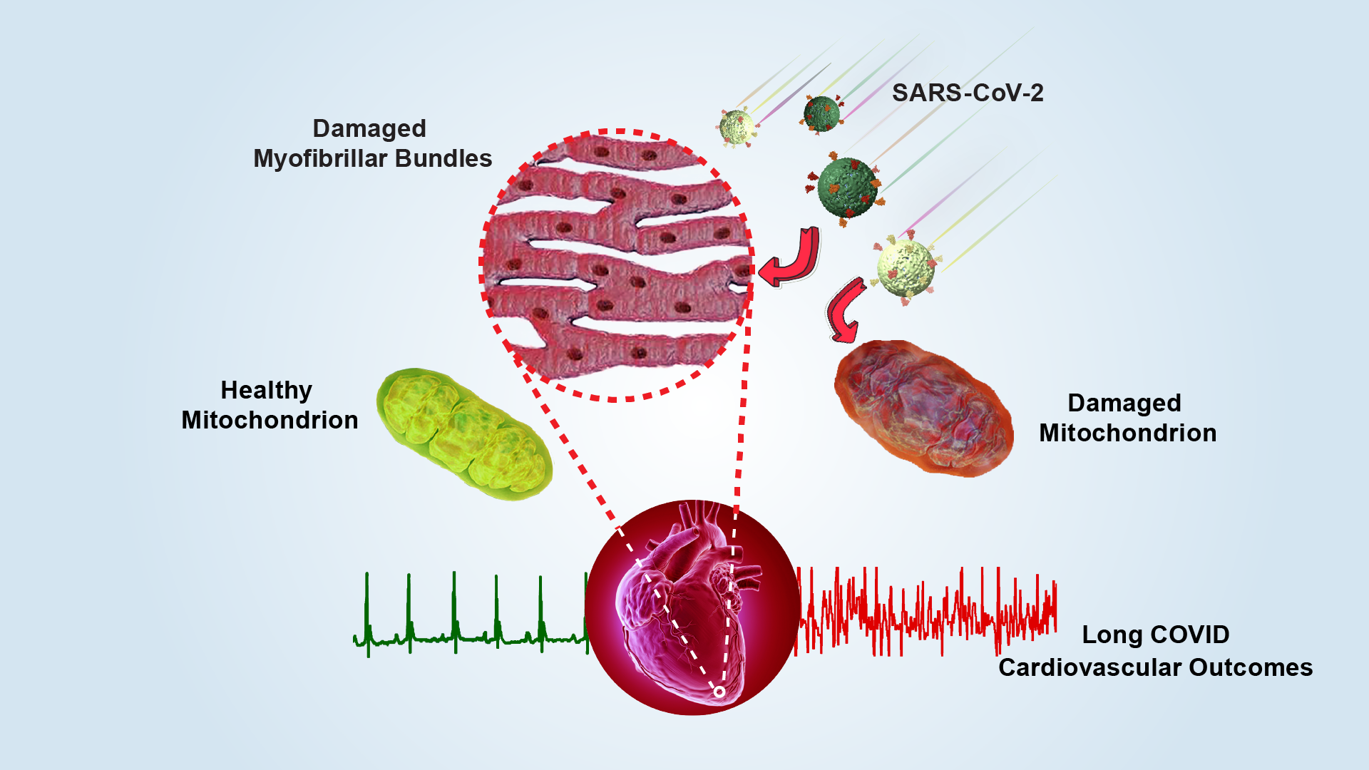 Researchers reveal mitochondrial structural damage in human hearts and uncover pathogenic mechanism of Long COVID-associated cardiovascular diseases