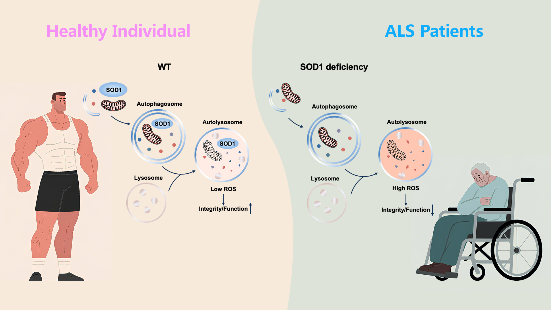 Researchers collaborate to uncover how SOD1 protects lysosome through autophagy