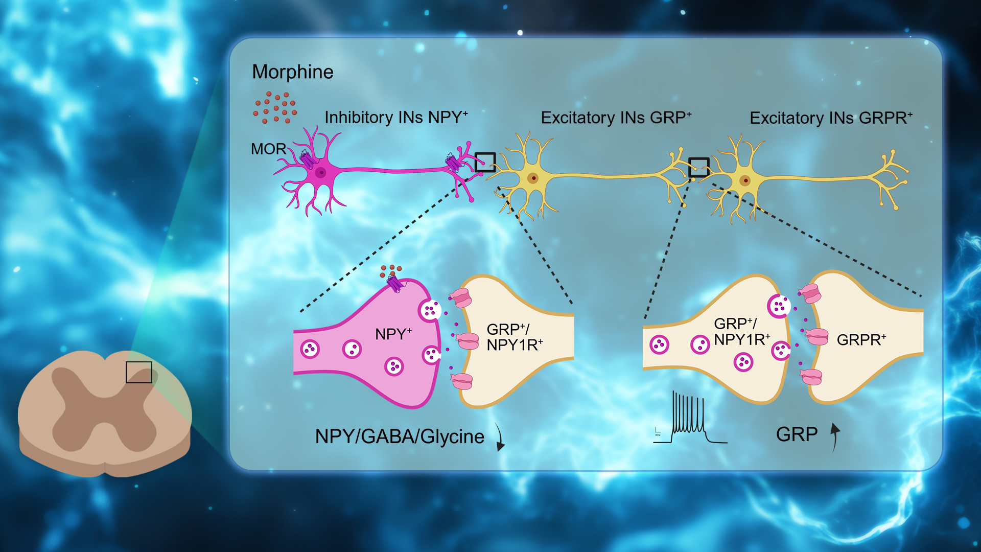 Researchers uncover how neuropeptide Y neurons mediate opioid-induced itch through disinhibition of GRP-GRPR microcircuits in spinal cord