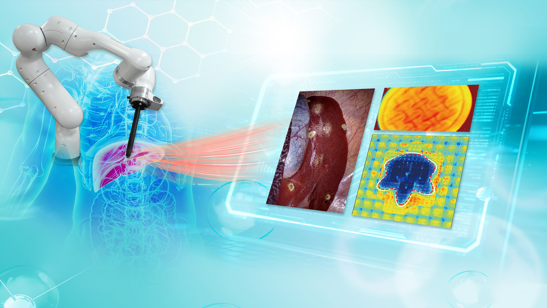 SUSTech Team Makes Progress in Visuo-tactile Perception for Medical Robots