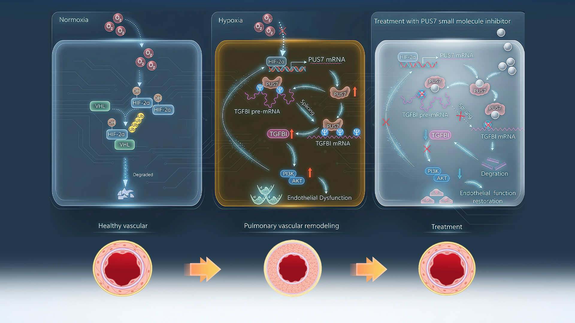 SUSTech Team Reveals Molecular Mechanism and Role of Pseudouridine Modification in Pulmonary Hypertension